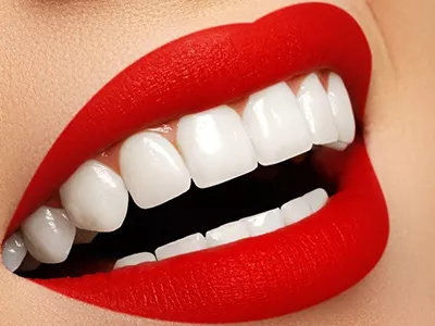 خدمات زیبایی دندان در کلینیک زیبایی زندیه