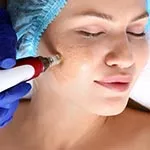 تکنیک بی بی گلو جهت روشن سازی و شفاف سازی پوست