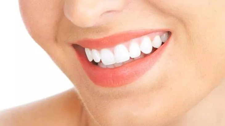 لبخندی جذاب با لمینت سرامیکی دندان در مطب دکتر سمیرا فراشاهیان همراه با 33٪ تخفیف و پرداخت 1350000 تومان به جای 1500000 تومان