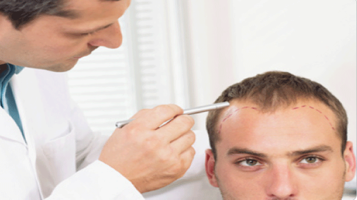 PRP پوست و مو در کلینیک به سیما تا 20٪ تخفیف