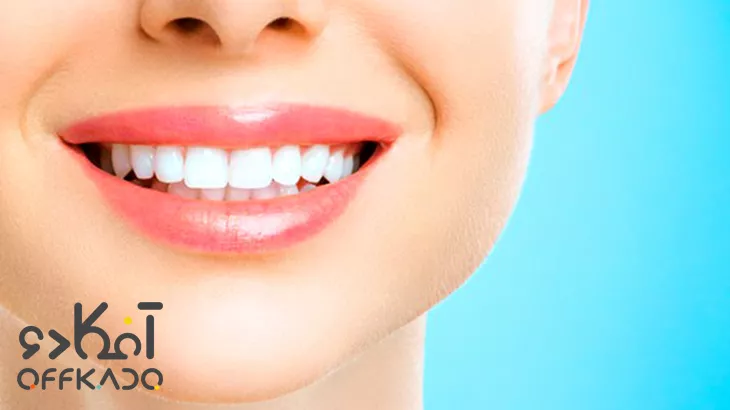 خدمات زیبایی دهان و دندان در کلینیک زیبایی زندیه با تخفیف ویژه آفکادو